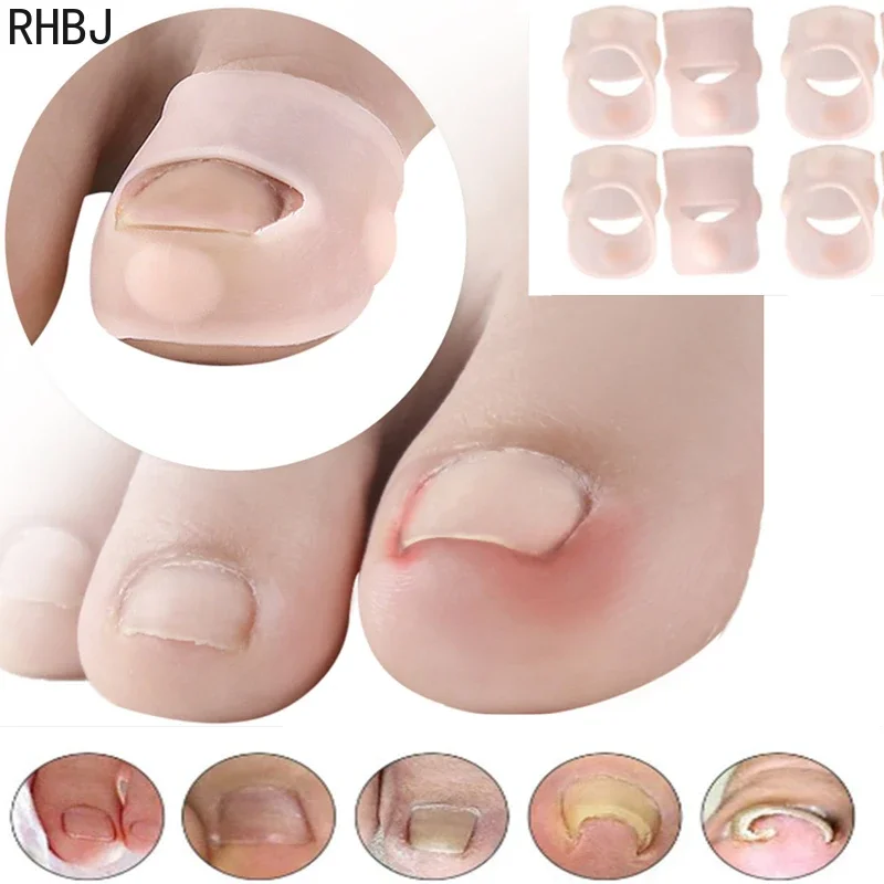 RHBJ Protector de corrección de uñas de los pies, separador de dedos, tratamiento de paroniquia, corrección de pedicura, herramienta para el cuidado de los pies, Clip alisador