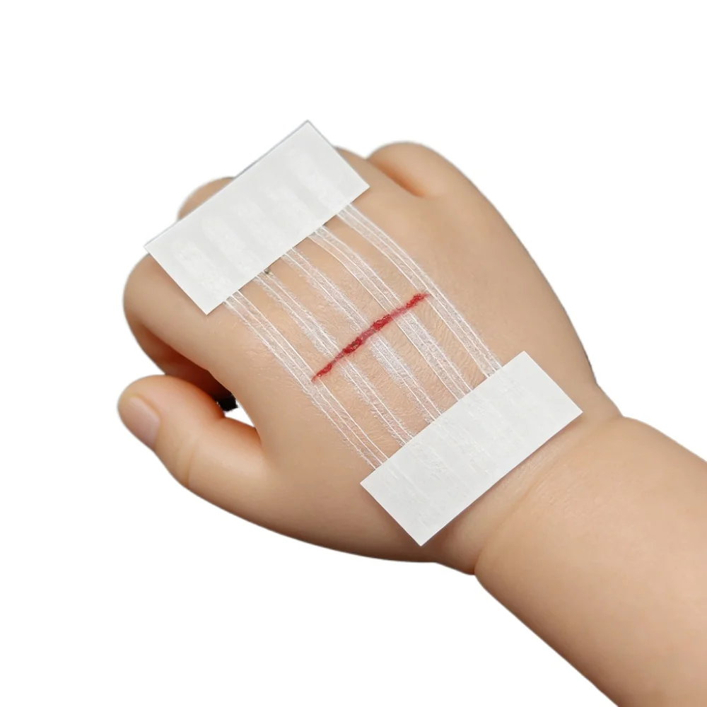 

5 полосок для закрытия ран, пластыри для послеоперационного восстановления, косметические хирургические полоски, адгезивная медицинская лента без швов, хирургическая лента без швов