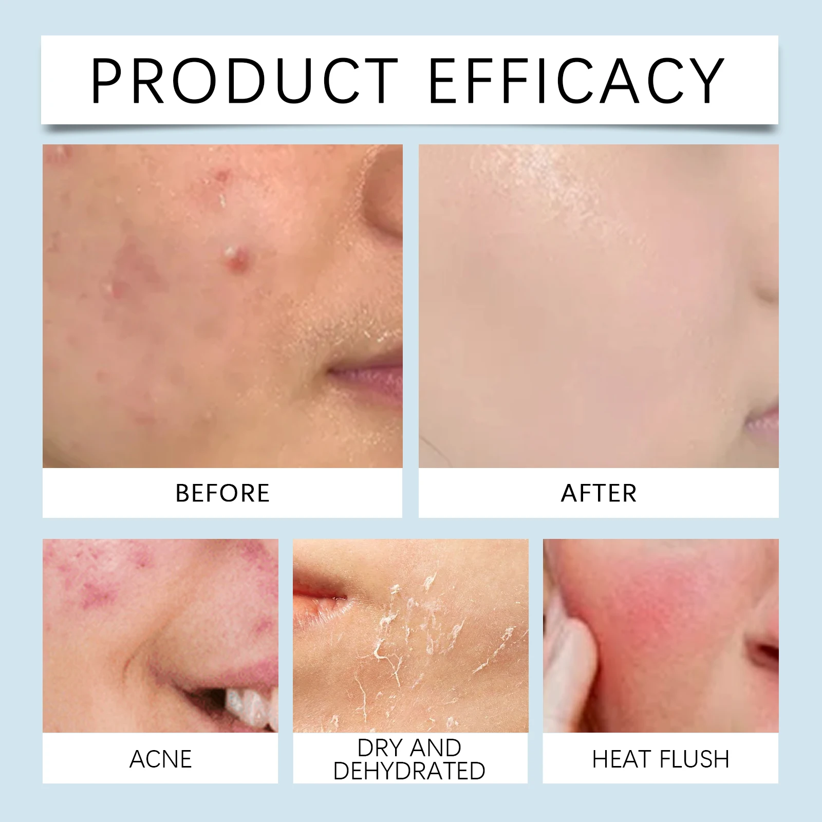 Увлажняющая сыворотка-роллер 0 – обзор и цена Luxury Skincare Serum