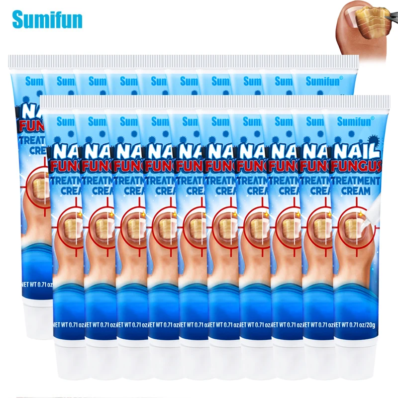 

10/20Pcs Sumifun Nail Fungus Care Cream Toe Paronychia Onychomycosis Antibacterial Ointment Antifungal Repair Medical Plaster