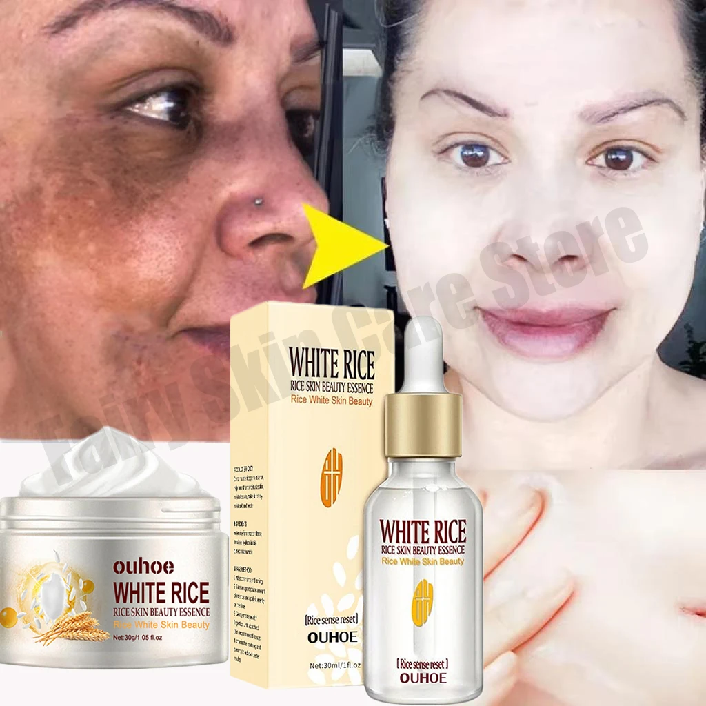 Weiße Reis aufhellung creme Anti-Aging verblassen feine Linien Gesichts creme Melanin pigment entferner verbessern stumpfe feuchtigkeit spendende Hautpflege