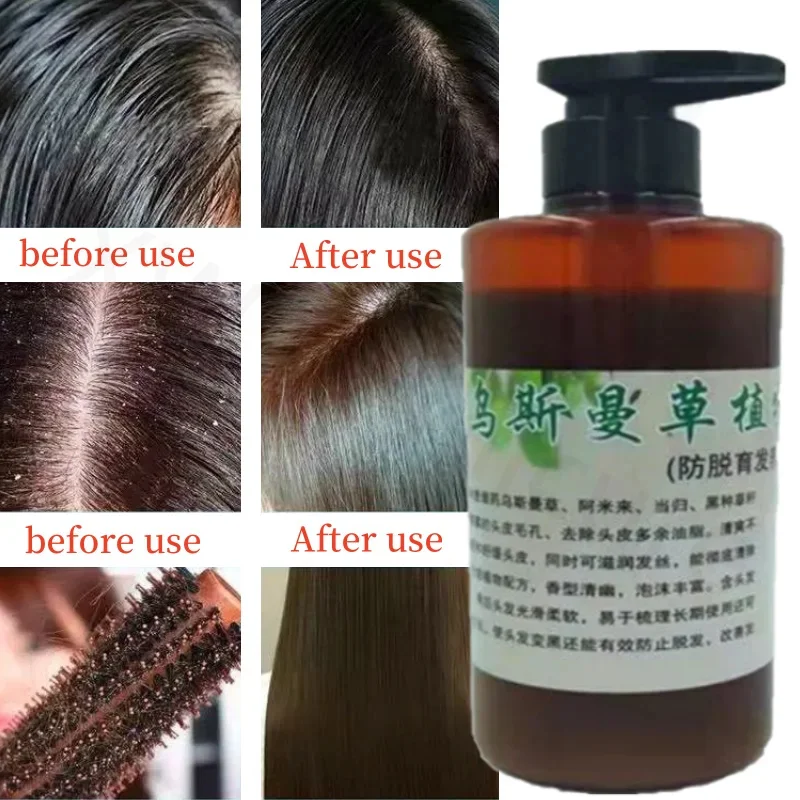 

480ml Usman Grass Shampoo Improves Frizz, Repairs Hair, Prevents Hair Loss, No Silicone Oil, Smooth and Bright Plant Shampoo