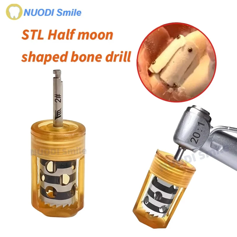 Dental Implant SLT Half Moon Bone Drill Implant Ring Drill Used for Incremental Bone Implantation Surgery To Extract Flake Bone