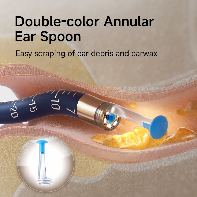 Bebird EarSight Plus Ear Tips Replacement Accessory Set - Image 3