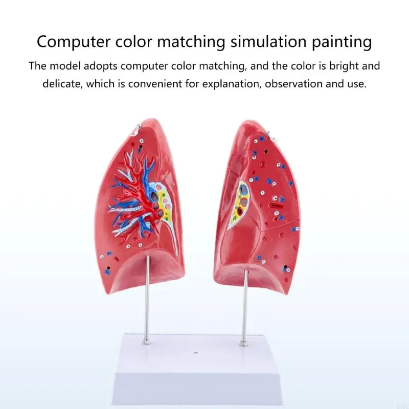 Anatomical Normal Lung Model with Removable Components for Clinical Teaching 