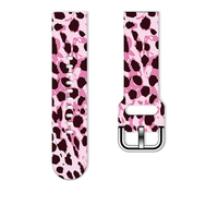 Animal Fur Print Series Strap for Samsung Galaxy Watch 7/6/5/4, 20mm 22mm Universal Band Fits 40mm 44mm Xiaomi Huawei Amazfit