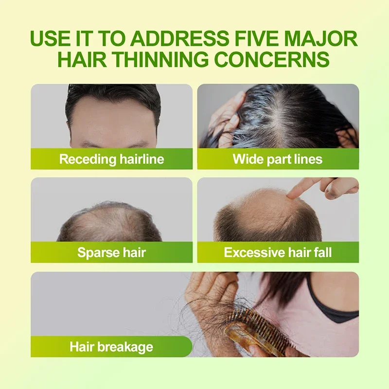 Thumbnail 2 - #50 Trending Hair Loss Treatments Right Now