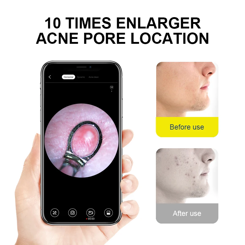 2022 Nieuwe Producten Smart Wifi Visual 5mp Ear Pick Wax Reinigingsstaaf Removal Tool Endoscoop Met Camera