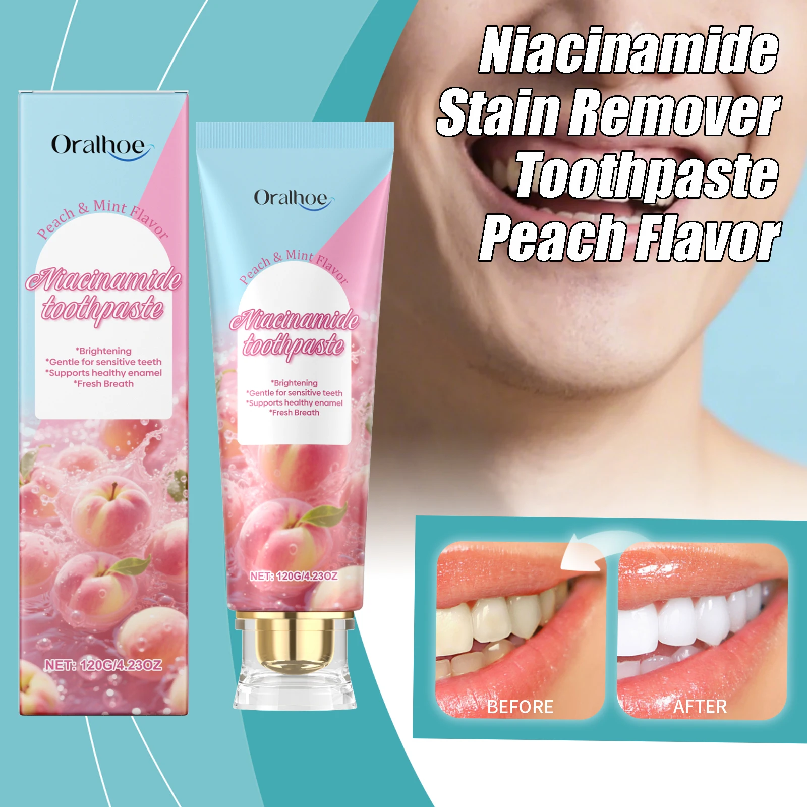 معجون أسنان مزيل بقع النياسيناميد يزيل البلاك الأسنان الصفراء حماية الأسنان المينا دائم التنفس الطازج معجون أسنان العناية بالفم