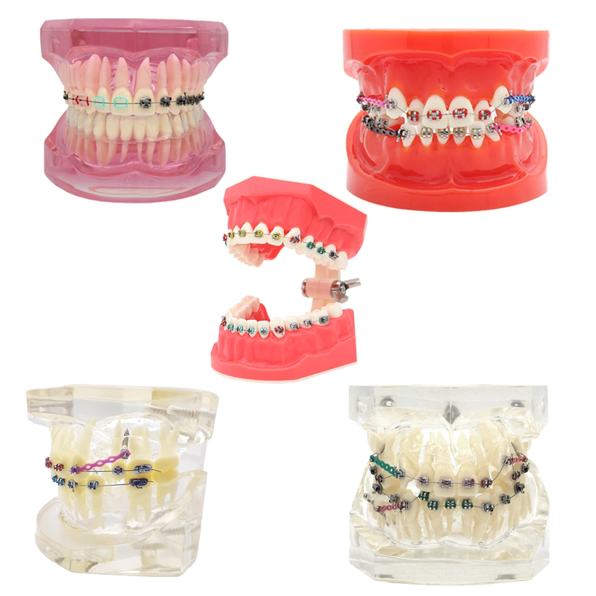 Dental Model With Braces Orthodontics False Teeth Modeling For Studying Teaching Patient Education Dentistry Accessories