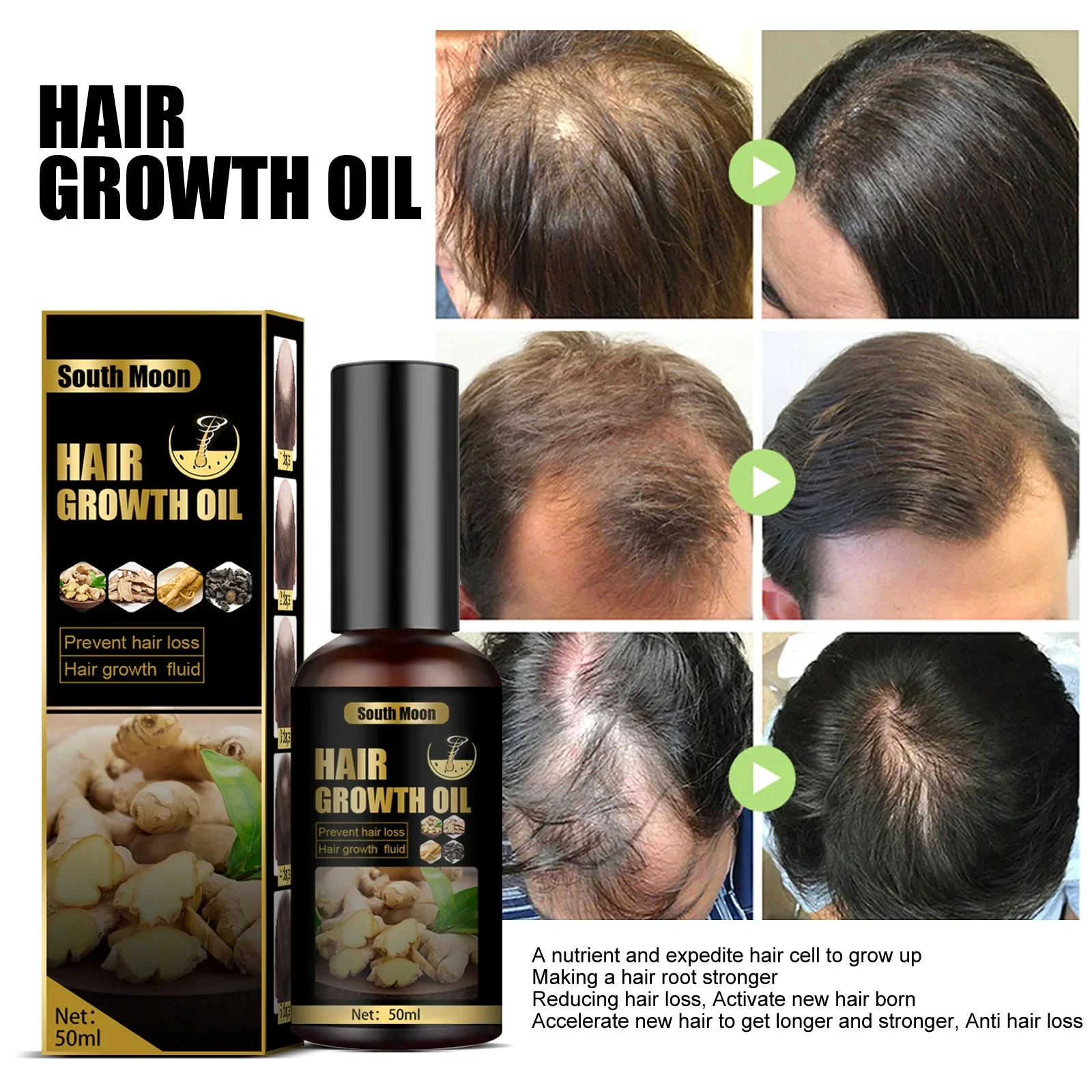 

Sdatter Hair Growth Essential Oil Products Effective Fast Growing Serum Prevent Hair Loss Scalp Treatment for Men Women