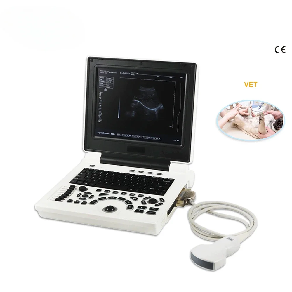 Digital B mode  diagnostic instruments SUN-806H