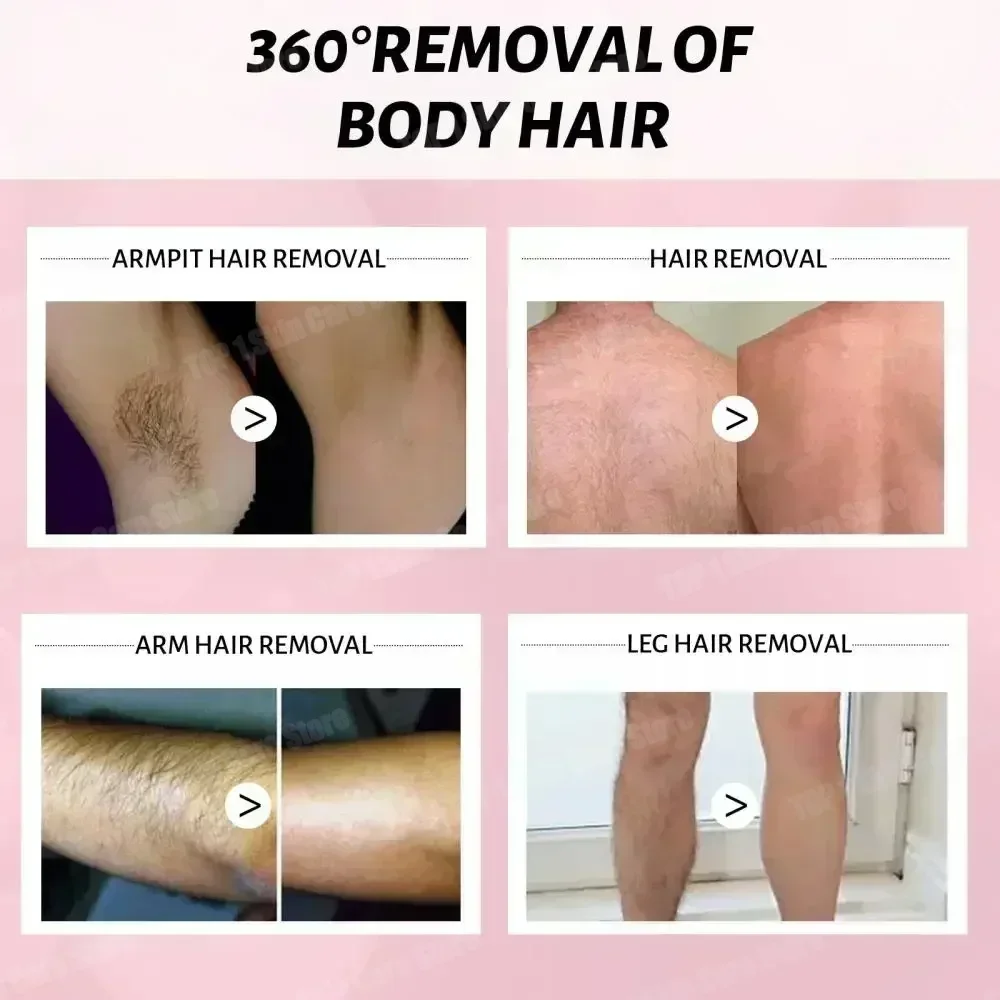 Рисунок 3 - Сыворотка для постоянного ингибирования волос