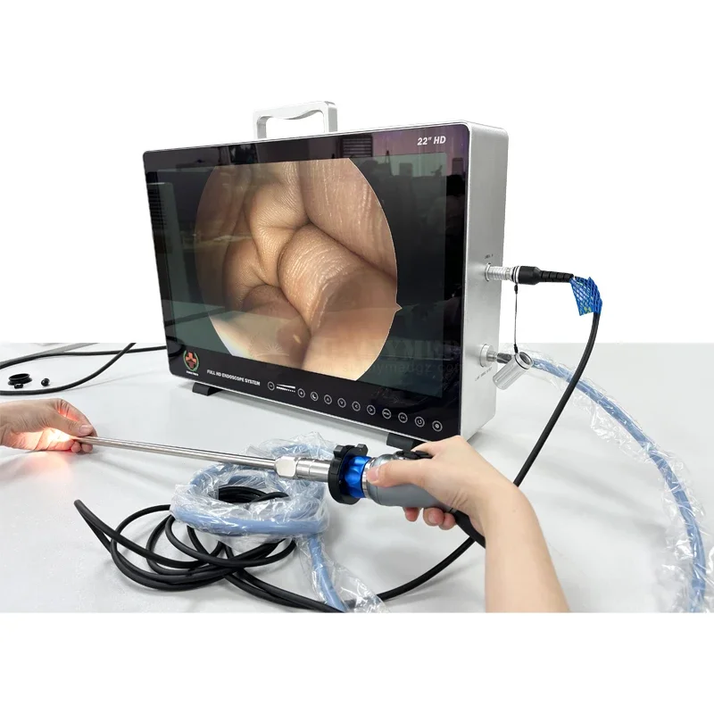 SY-PS050 rigid endoscope system hysteroscopy medical 1080P ENT endoscopy laryngoscope