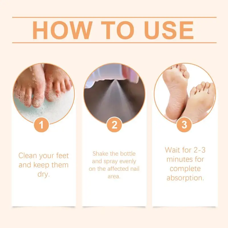 Venom Nail Fungus Repair Spray Gray Nail Treatment Onychomycosis Paronychia Removal Relieve Foot Odor Hand Foot Nail Care Bee