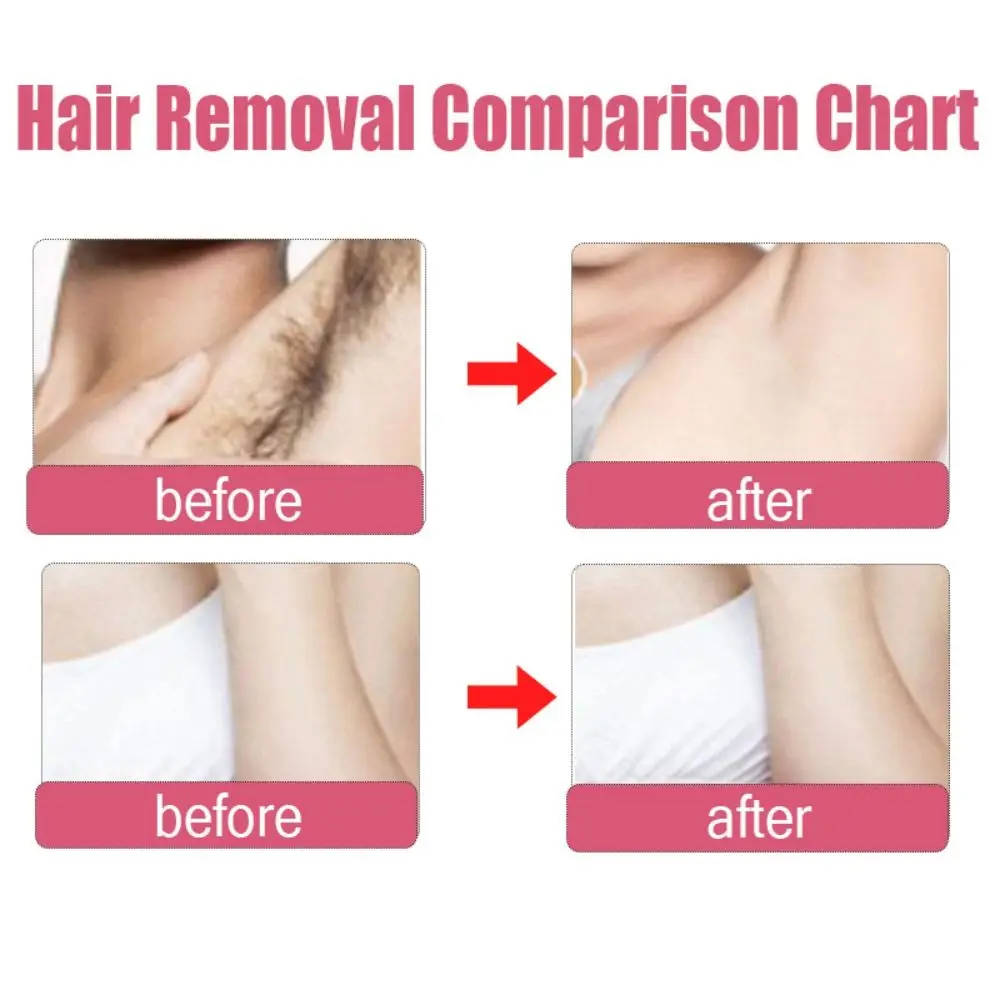 Painless Hair Removal Cream Effective Full Body Repair Skin Care Depilatory Cream Non-Irritating Gentle Beauty