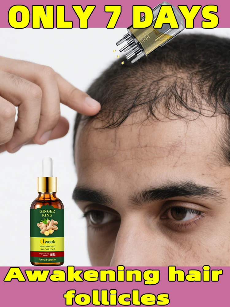 

Аппликатор для кожи головы, жидкая расческа для лечения кожи головы, пробуждающие фолликулы общежития для посторонних волос, масло-сироватка для роста волос