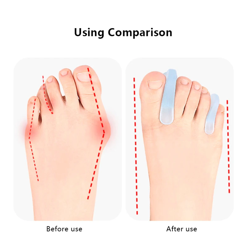 Foot Care Tool Silicone Toe Separator Hallux Valgus Bunion Adjuster Corrector Silicone Thumb Corrector Protector Straightening