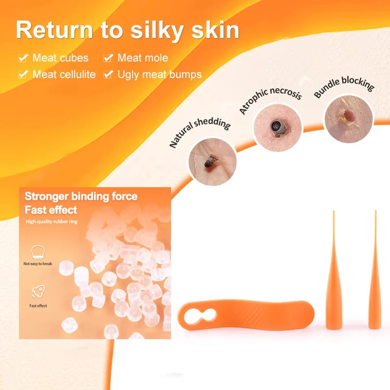Zestaw narzędzi 2-w-1 do bezbolesnego usuwania brodawek, znamion, plam, zaskórników i kurzajek z pisakiem do usuwania oraz wacikami do czyszczenia, narzędzie do pielęgnacji skóry twarzy