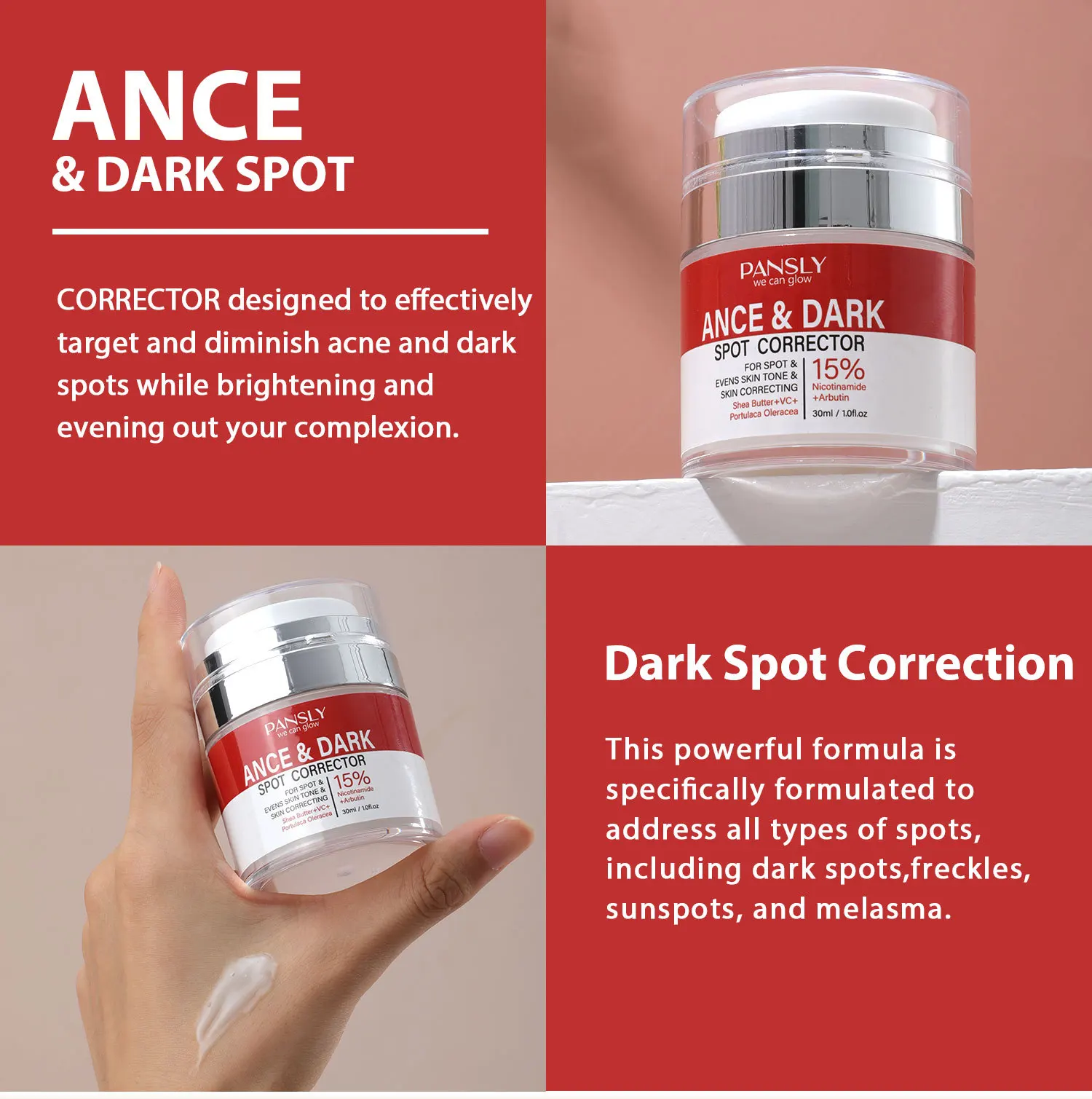 15% VC Anti-acne Niacinamide Black Spot Cream Poriënreinigende Anti-acne Crème Gezichtszwarmende Crème