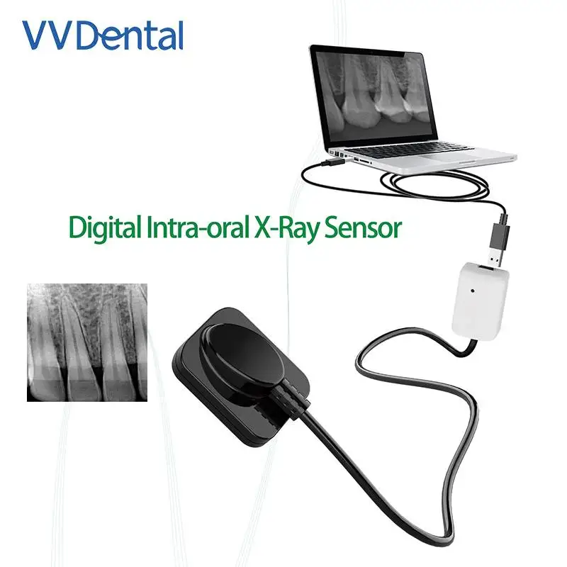 Dental Sensor Digital Intraoral Intra-Oral X-Ray Sensor Imaging System RVG XRay Sensor Instrument Tools