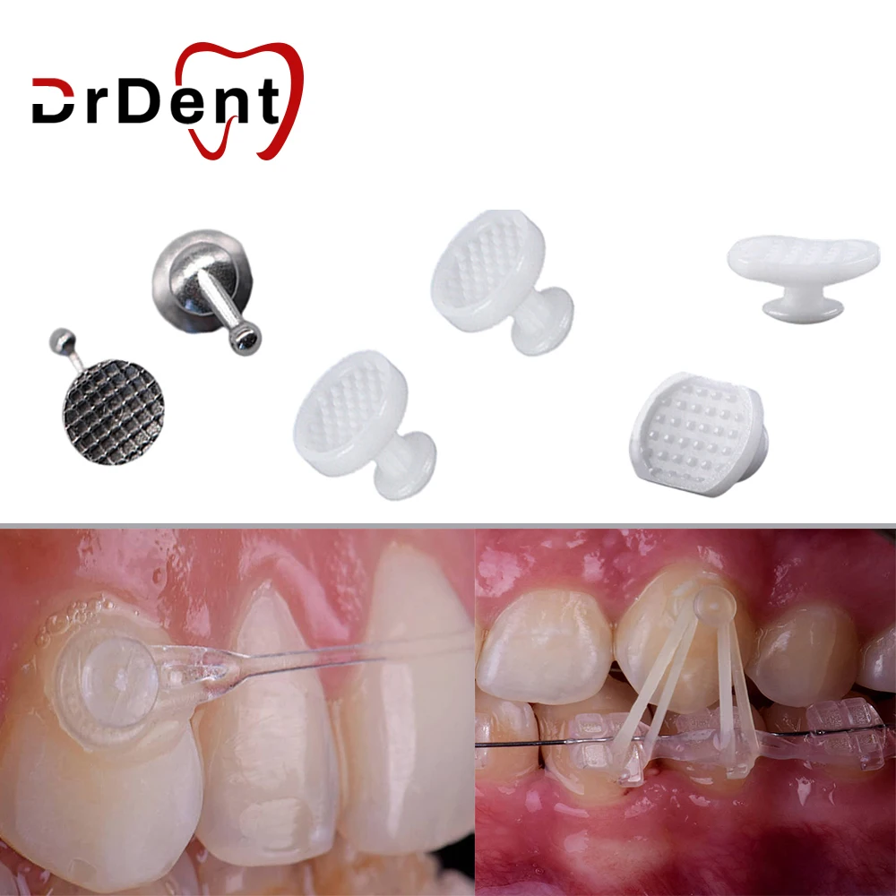 Drdent: La Soluzione Innovativa per la Correzione Dentale con Ceramica Chiara