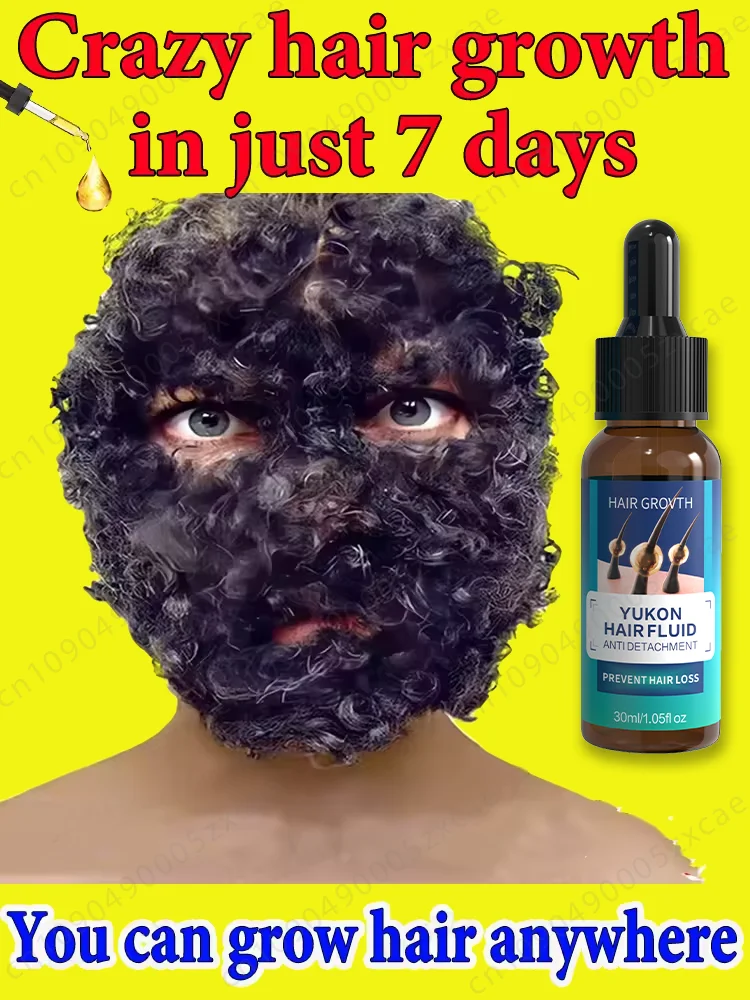 모발 성장 에센셜 오일, 최신 연구 결과, 어디서나 모발 성장 가능 대머리 및 탈모 복구