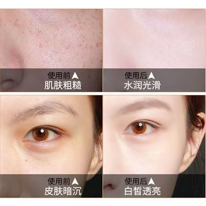 Fuerte eficaz mejor crema blanqueadora Facial cuello manos pies sin efectos secundarios negro oscuro iluminar el cuidado 100g