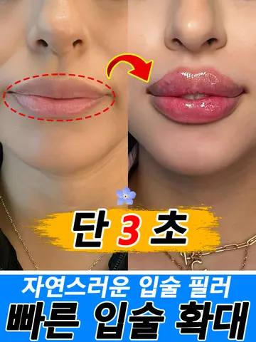 수술 없이 즉각적인 입술을 통통하게 만들어보세요 수술 없이 즉각적인 입술을 통통하게 만들어보세요