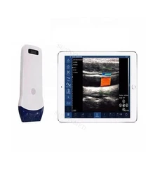 SY-5L Portable Medical Color Doppler Probe Pocket Wireless Wi-Fi Ultrasound Machine wireless ultrasound scanner