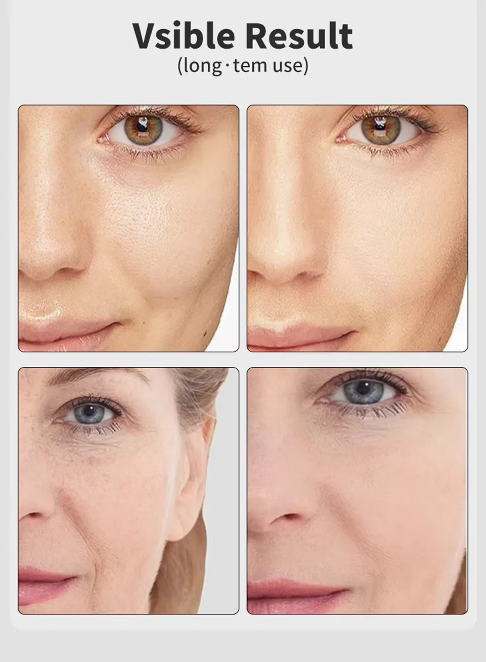 7 สี Age-R Booster Pro บํารุงผิวหน้าต่อต้านริ้วรอยอุปกรณ์ความงาม EMS Microcurrent Lift Massager ใช้ในบ้าน Beauty Skin Care