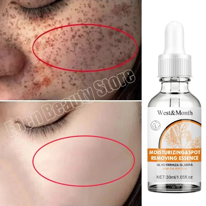 

Nicotinamide Whitening Face Serum Remove Dark Spots Freckles Fade Melanin Essence Brighten Anti Aging Korean Skin Care Products