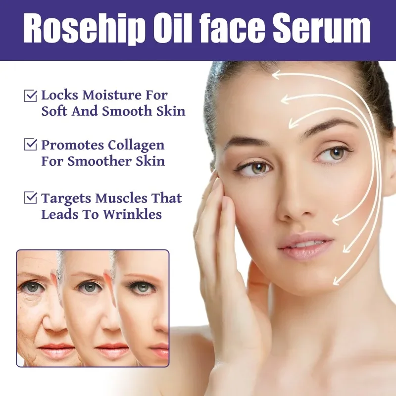 Essência facial do óleo da rosa mosqueta, Remova pontos escuros, desvanecer-se linhas finas, Anti enrugamento, envelhecimento, firmando, clareando, hidratando