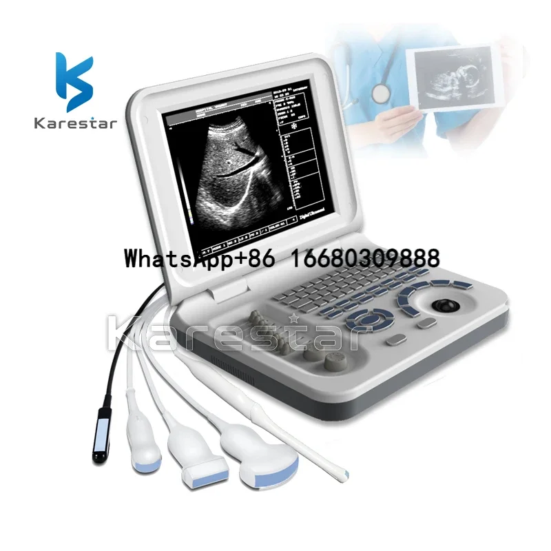 

Katrestar K-H200 Factory Wholesale Medical UItrasound Devices Digital Laptop Second Hand Ultrasound Machine