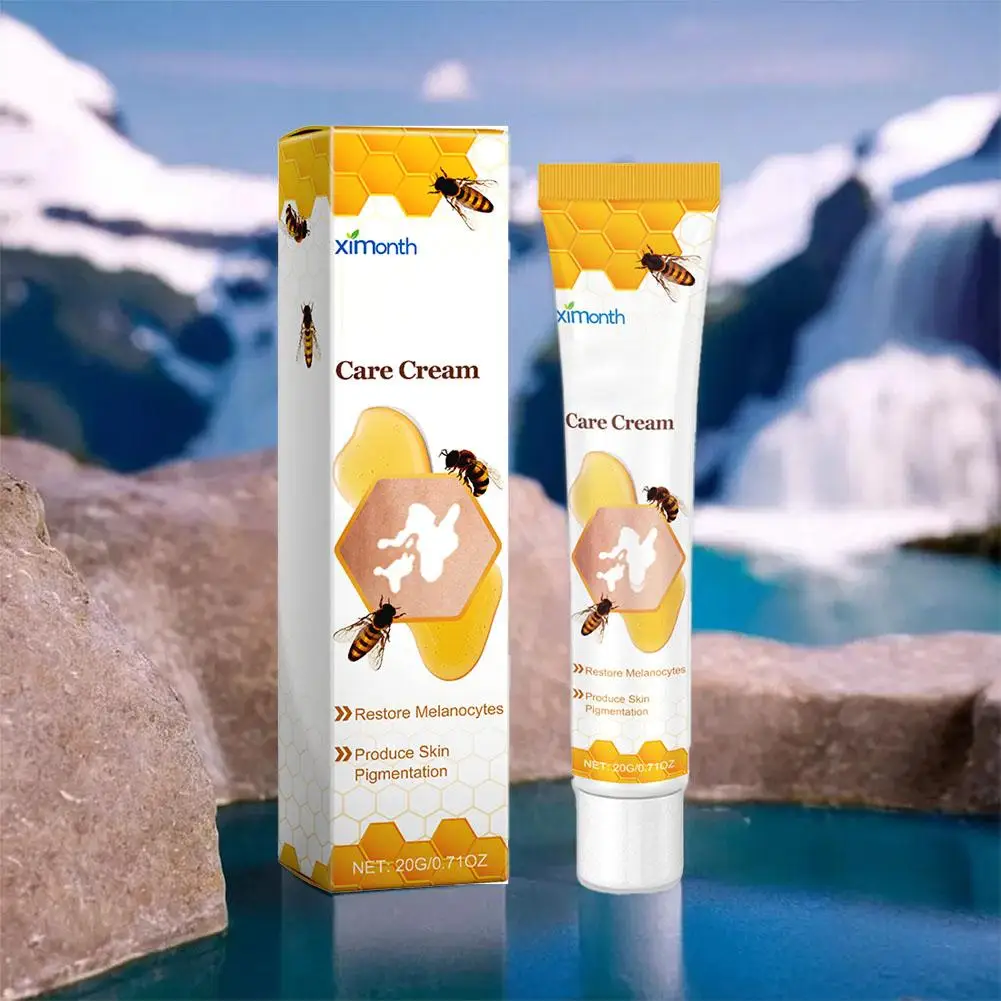 Crème réparatrice pour le traitement du vitiligo, essence, élimination des taches blanches, produit de soin, nouvelle équation