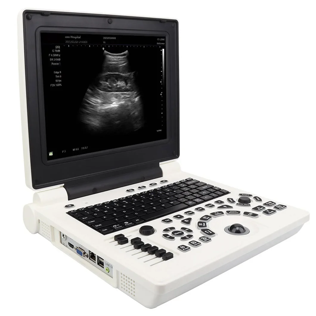 

Clinic Hospital OB/GYN Laptop Portable Ultrasound System Price of Machine