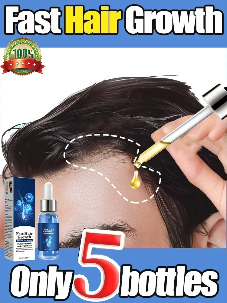 Effective Fast Hair Growth Serum Baldness Repair Hereditary Postpartum Seborrheic Anti Loss Care for Men Women Scalp Cares