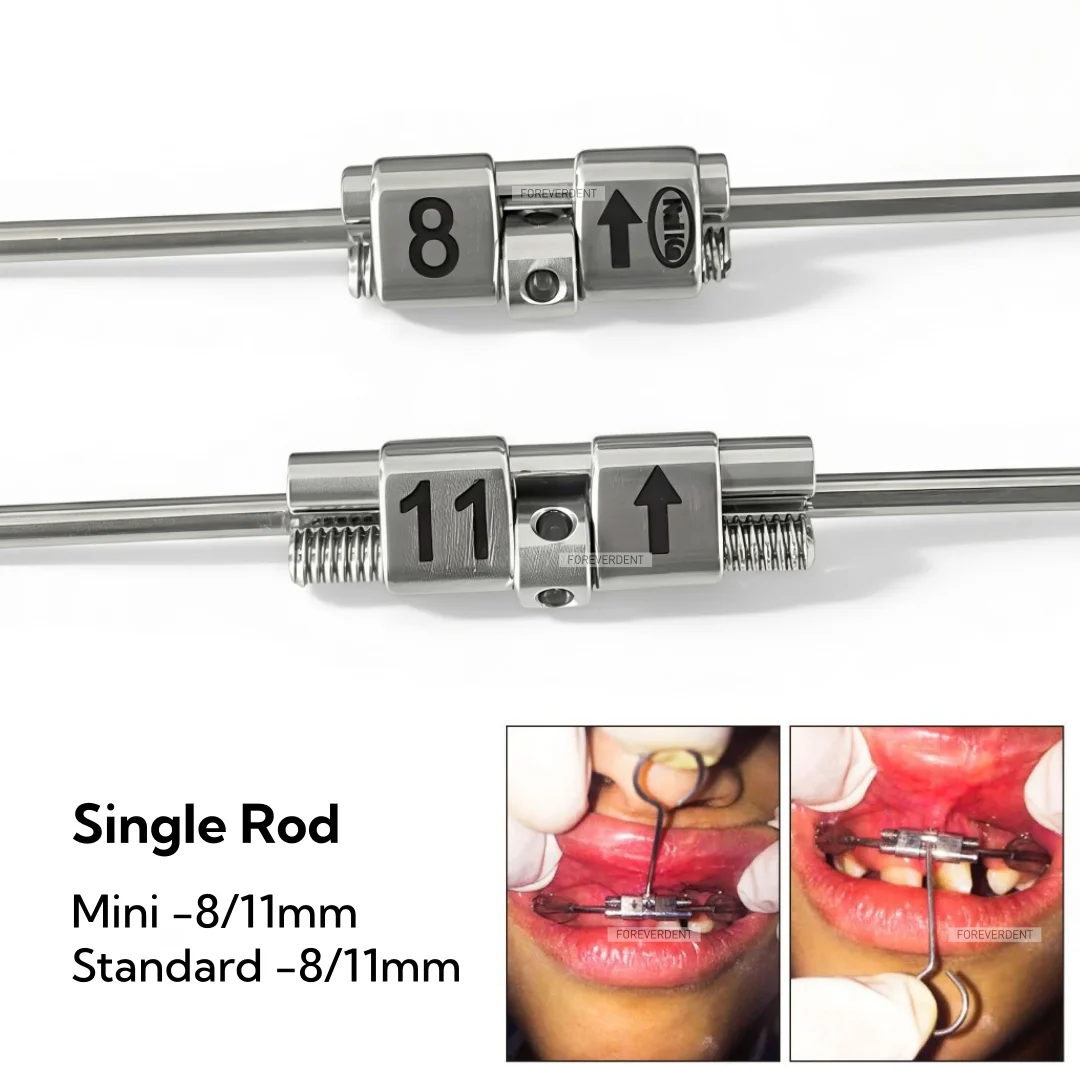 Dental Orthodontic Special Variety Expansion Screw Hyrax Rapid Palatal Expander with Swivel Key Stainless Ortho Tools