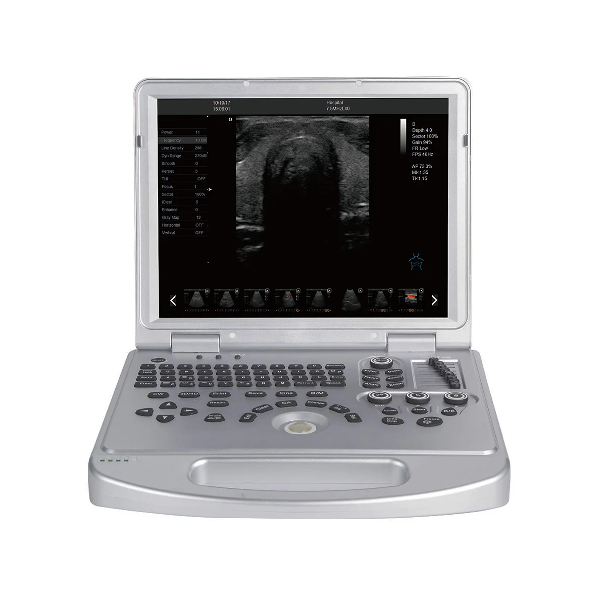 DAWEI Brand New veterinary ultrasound scanner portable small animal ultrasound machine