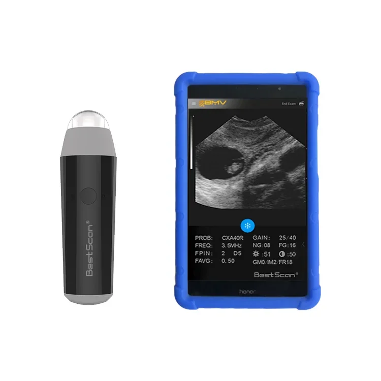 Hot sale Wireless Portable Veterinary Color B Ultrasound Scanner WaterProof Animal Pig Sow Sheep Pregnancy Ultrasound Tester