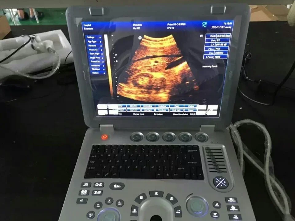 3D 4D Full Digital Medical Doppler Ultrasound cheap medical ultrasound instruments Sunbright