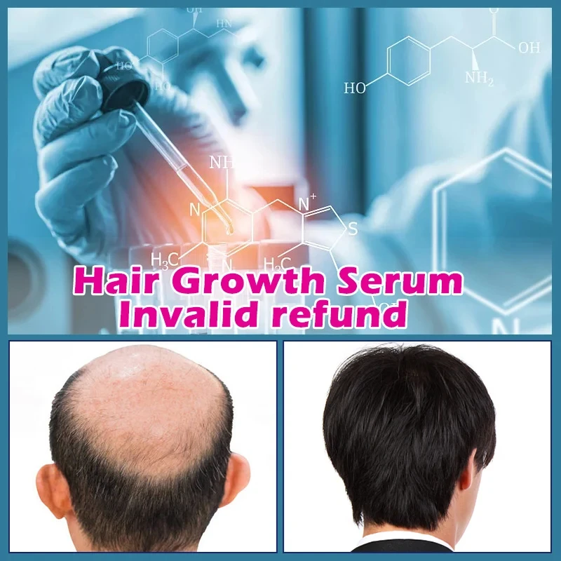 Hair Care Essential Oil Hair Growth Serum Promotes Thicker Growth Hair Prevent Hair Loss Treat dry damaged hair Thinning hair