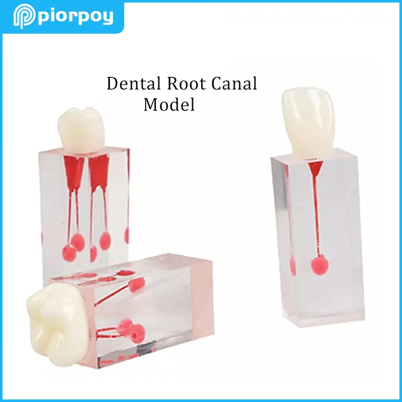 

Dental Endodontic Tooth Root Canal Study Model Rotary Files RCT Practice Blocks Pulp Cavity Dentist Training Resin Models