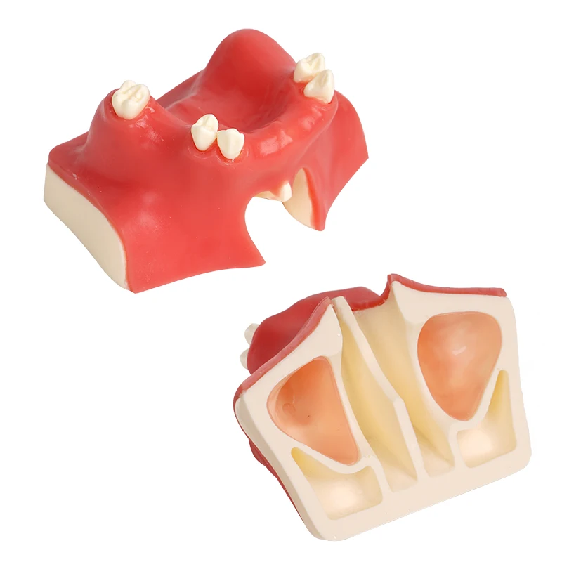 1pc Maxillary Sinus Teeth Model Dental Implant Student Teaching Practice Model Upper Jaw Sinus Lift Implants Restoration Model