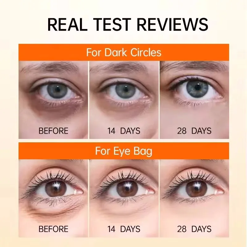 إزالة التجاعيد الفورية كريم عين الكولاجين إزالة الخطوط الدقيقة أكياس العين مكافحة الهالات السوداء الانتفاخ ترطيب ثبات العناية بالعين #2