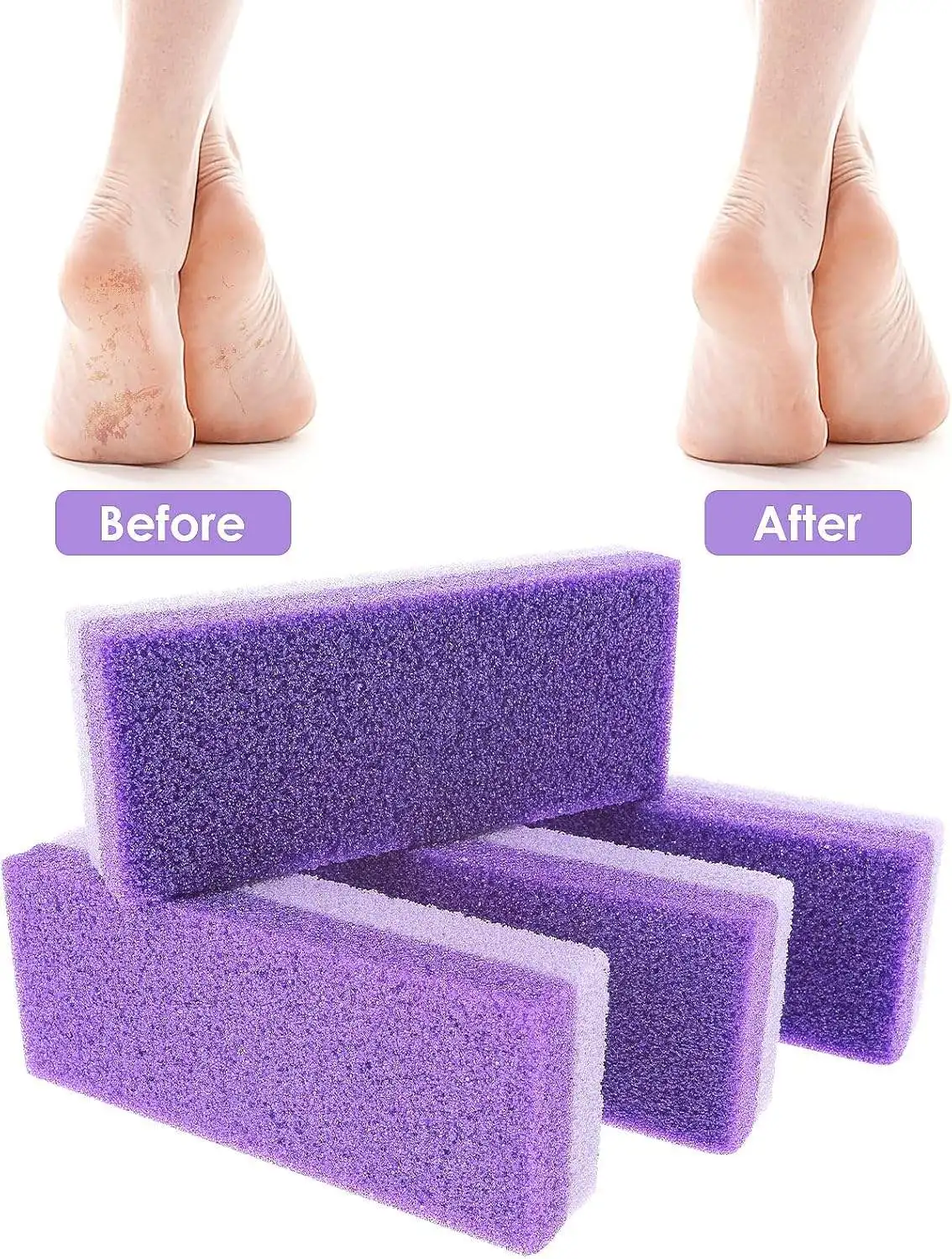 1-10Pcs Foot Pumice Stone Foot File Callus Dead Skin Remover Heel Scrubber Pedicure Exfoliator Tool Smooth Feet Care Easy to Use