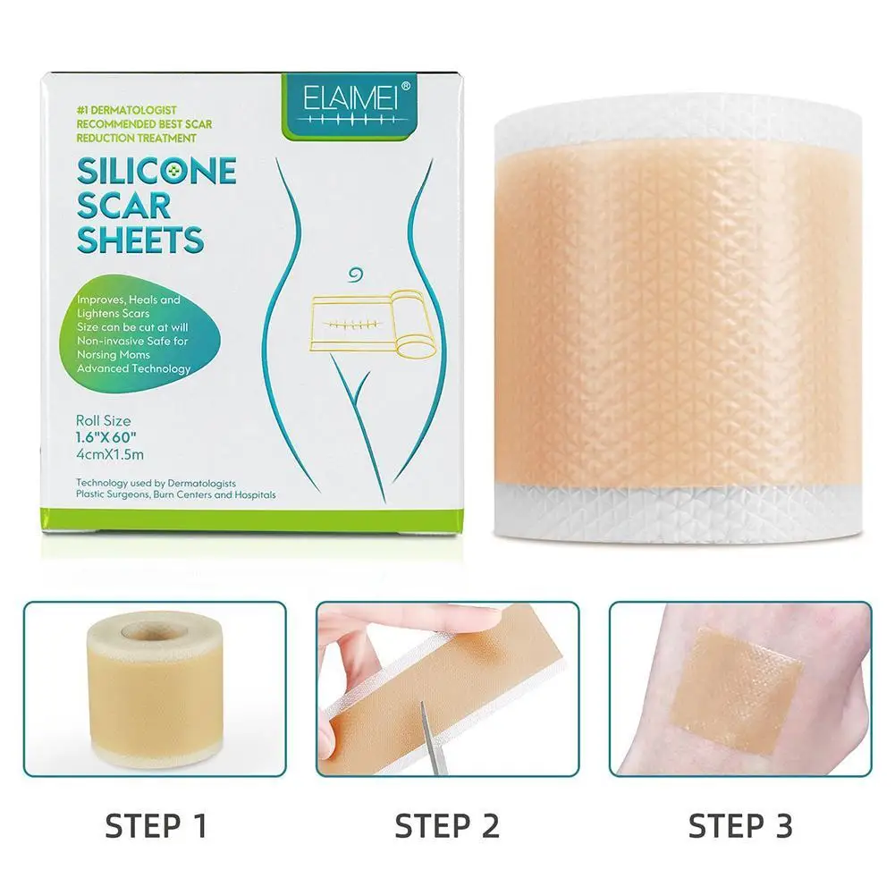 150cm Silicone Gel Scar Sheet Patch Treatment Removal Tape Acne Trauma Burn Scar Cover Skin Repair Section Ear Beauty