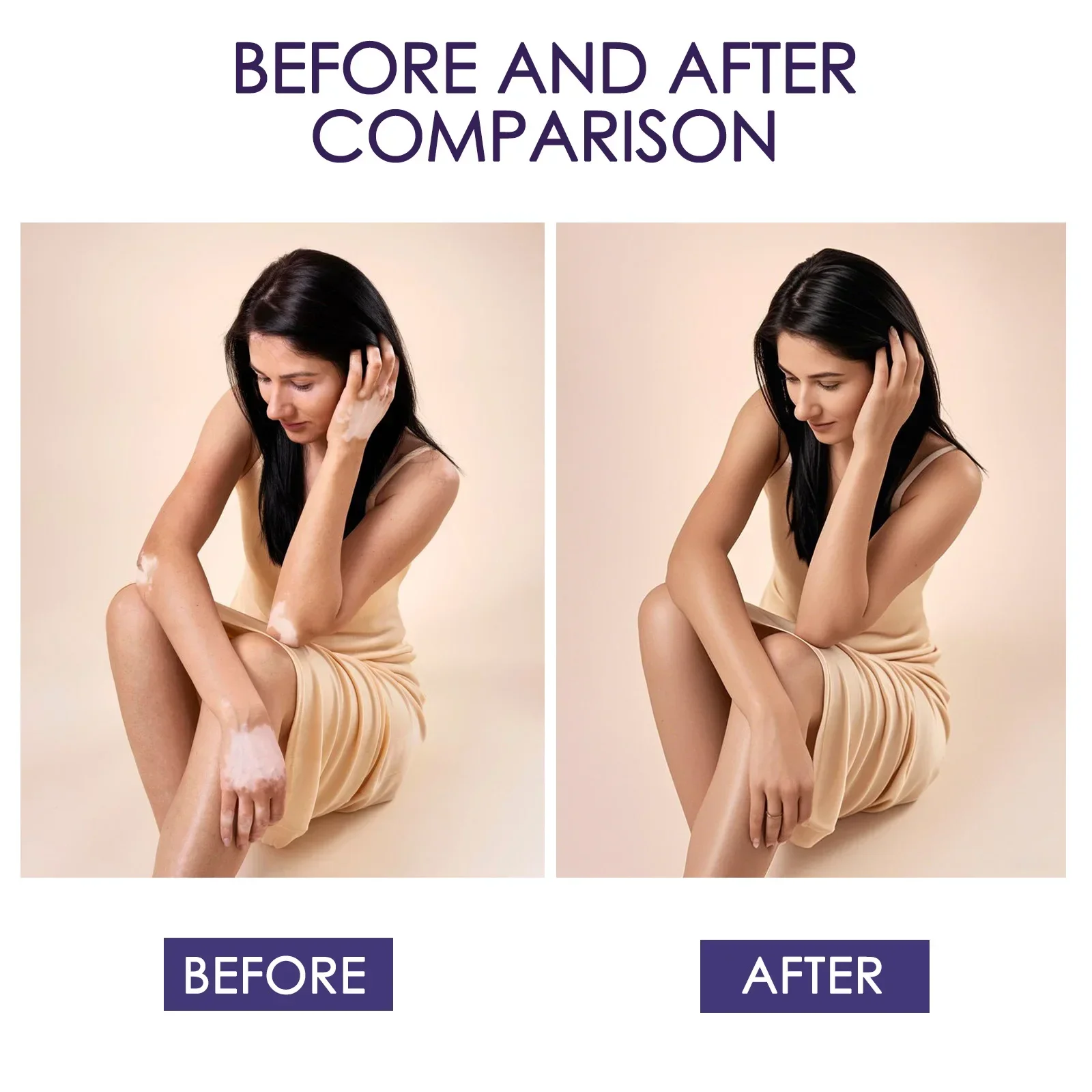 1-3 個タトゥーボディコンシーラーメイクアップタトゥー/傷跡/スポット/日焼けハイカバークリーム長期持続防水フェイスファンデーション 103ML