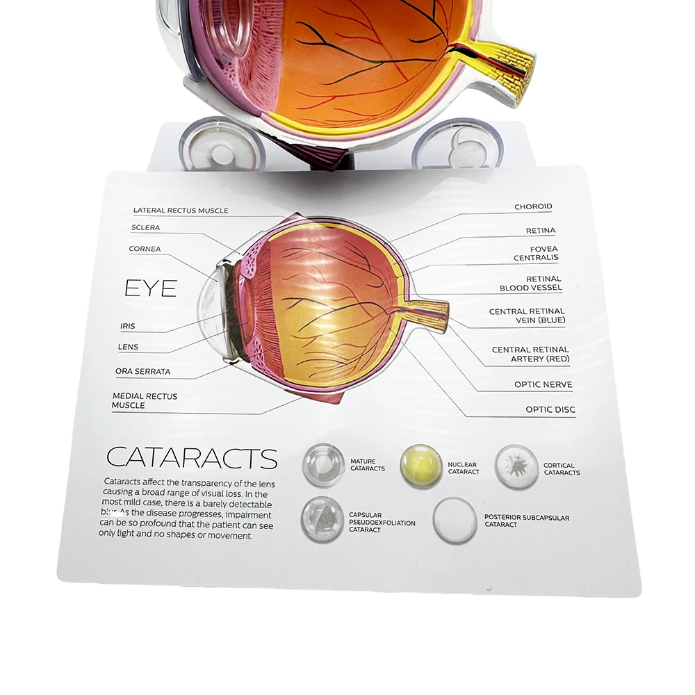 Anatomical Imitative Eye Model for Ophthalmic Training and Medical Education Teaching Display