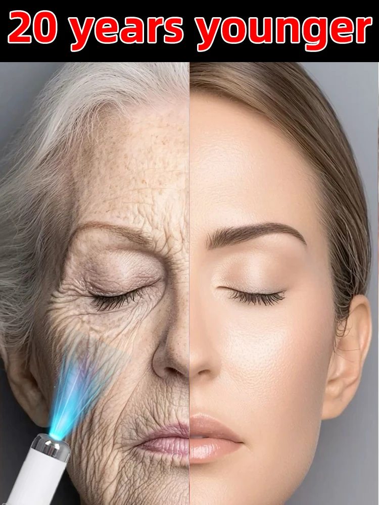 

Erase Wrinkles in Just 7 Days Make you beautiful again